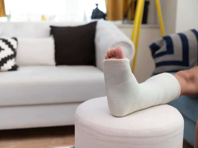A broken leg in a white cast resting on an ottoman after a personal injury.